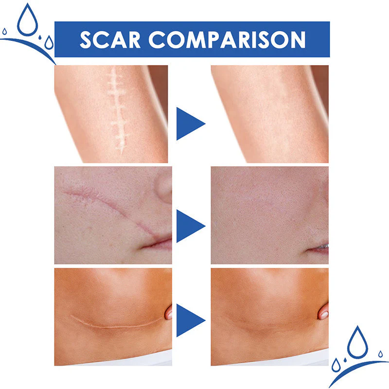 ScarRepairCream_28df89d5